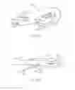 Fig. 87 - Systems and methods for delivering a medical implant