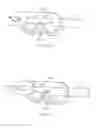 Fig. 88 - Systems and methods for delivering a medical implant