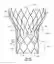 Fig. 02 - Reduced profile prosthetic heart valve
