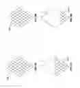 Fig. 12 - Reduced profile prosthetic heart valve