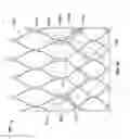 Fig. 15 - Reduced profile prosthetic heart valve