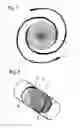 Fig. 03 - Intraocular lens having helical haptics of shape memory