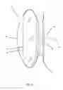 Fig. 03 - Prosthetic implant devices
