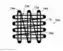 Fig. 01 - CONNECTIVE TISSUE REPAIR