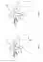 Fig. 02 - IN-SITU FORMATION OF A JOINT REPLACEMENT PROSTHESIS