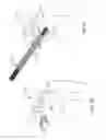 Fig. 06 - IN-SITU FORMATION OF A JOINT REPLACEMENT PROSTHESIS