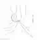 Fig. 22 - IN-SITU FORMATION OF A JOINT REPLACEMENT PROSTHESIS