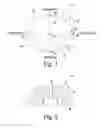 Fig. 04 - Method of implanting a reverse shoulder orthopaedic implant having a metaglene component with a screw locking cap