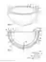Fig. 02 - Deforming implant-bone interface
