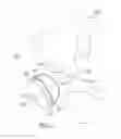 Fig. 04 - Deforming implant-bone interface