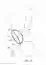 Fig. 05 - Deforming implant-bone interface