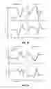 Fig. 09 - Impedance parameter power control for lower limb assistive device