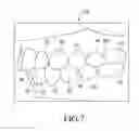 Fig. 08 - Method for assessment of orthodontic treatment