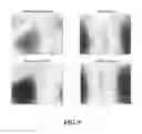 Fig. 08 - Method To Translate Biodynamic Spectrograms Into High-Content Information