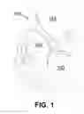 Fig. 02 - CONCUSSION REDUCTION SYSTEMS AND DEVICES AND METHODS TO USE THE SAME