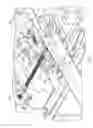 Fig. 08 - Adjustable person support system with expansion wings driven by dual leadscrews and center mounted motors