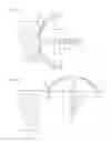 Fig. 14 - UNIT FOR PREVENTING BODY PART OF USER FROM BEING CAUGHT IN DOOR