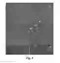 Fig. 09 - Pretreatment method for reduction and/or elimination of basal plane dislocations close to epilayer/substrate interface in growth of SiC epitaxial films