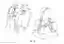 Fig. 15 - Multi-chamber, multi-formulation fluid delivery system