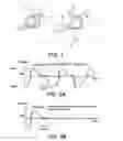 Fig. 02 - Method and apparatus for breathing assistance