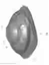 Fig. 02 - Attachment Device for a Tracheostoma Valve