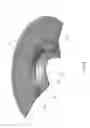 Fig. 07 - Attachment Device for a Tracheostoma Valve