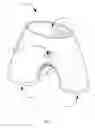 Fig. 02 - Barrier Device to Reduce Contact and Transmission of Pubic, Upper Thigh, and Buttocks Mediated Sexually Transmitted Diseases