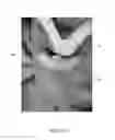 Fig. 09 - EYE LASH POSITIONING SYSTEM