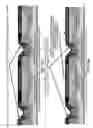 Fig. 26 - Metal foil metallization for backplane-attached solar cells and modules