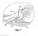 Fig. 07 - HOE FOR FACILITATING WORKING ON AT LEAST TWO SIDES OF A PLANT SIMULTANEOUSLY