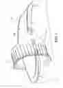 Fig. 02 - Sound reduction system
