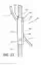 Fig. 08 - Strap guide insert
