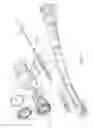 Fig. 04 - Anvil assembly and delivery system