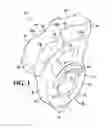 Fig. 02 - Stepped shredder hammers