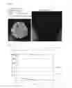 Fig. 04 - Capsule for non-ferrous metal collection and method for collecting non-ferrous metal
