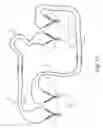 Fig. 07 - Extendable jumper cables