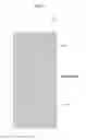 Fig. 08 - Liquid crystal display