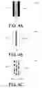 Fig. 05 - Model eye producing a speckle pattern having a reduced bright-to-dark ratio for use with optical measurement system for cataract diagnostics