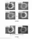 Fig. 06 - Systems and methods for mapping the ocular surface