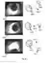Fig. 07 - Systems and methods for mapping the ocular surface