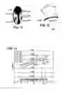 Fig. 07 - Method for providing a personalized spectacle lens optical system for a wearer