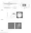 Fig. 02 - Dual mode microendoscope concentrating light emission into ring area