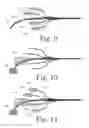 Fig. 09 - Method for brightness enhancement and modes manipulation of a multimode optical fiber