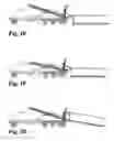 Fig. 13 - Vehicle hook hoist