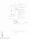 Fig. 12 - Working machine with hydraulic hose and boom intermediate portion