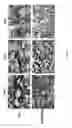 Fig. 02 - Compositions and Imaging Methods Comprising Detectably Labeled Phosphatidylethanolamine-Binding Peptides