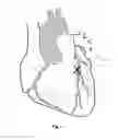 Fig. 02 - Biodegradable elastomeric patch for treating cardiac or cardiovascular conditions