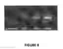 Fig. 10 - Methods for modulating Th1/Th2 cell balance by increasing leptin activity