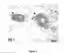 Fig. 02 - Compositions and methods useful for the treatment of neuromyelitis optica spectrum disorders