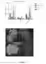 Fig. 06 - Vaccine and uses thereof